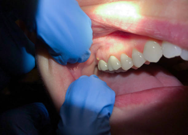 Best Emergency Dental Surgery in Aquia Harbour, VA
